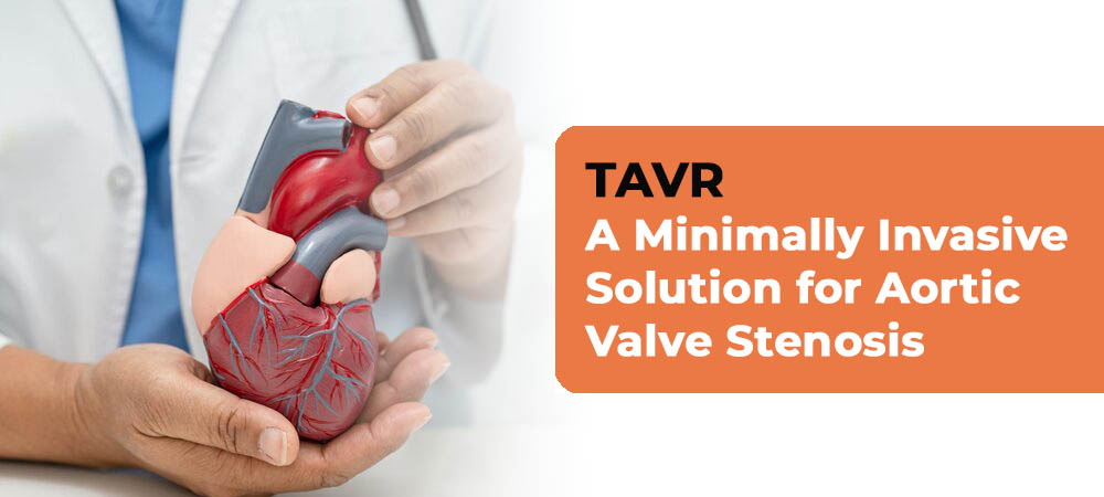 tavr-procedure-noida